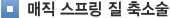 매직 스프링 질 축소술